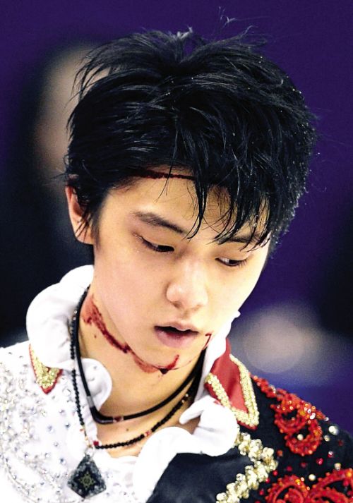 羽生结弦日本接受检查完全治愈需23周
