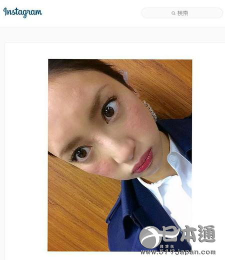 菜菜绪INS玉照满脸包 疑患寒冷性荨麻疹