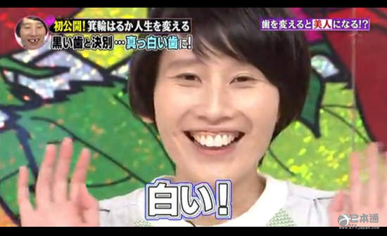 牙齿不自然、有违和感的日本女星TOP10