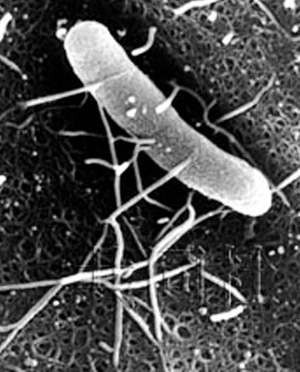 日本公布全球首张超级细菌照片