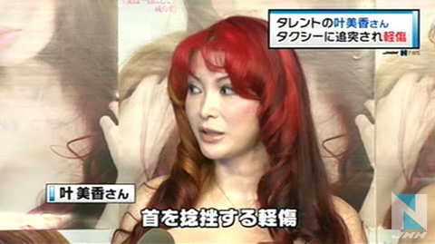 日本艺人叶美香凌晨在东京被出租车撞到轻伤 日本通