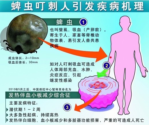 日本国内首次确认蜱虫感染致死病例