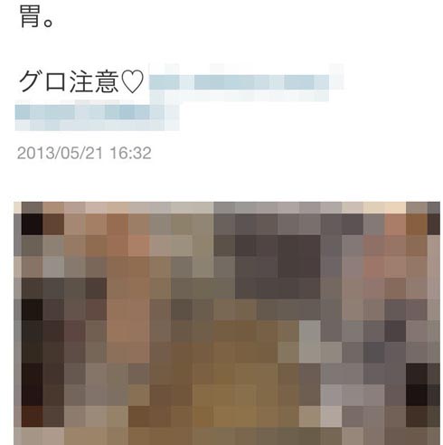 日本一卫校学生推特上晒人体内脏遭批