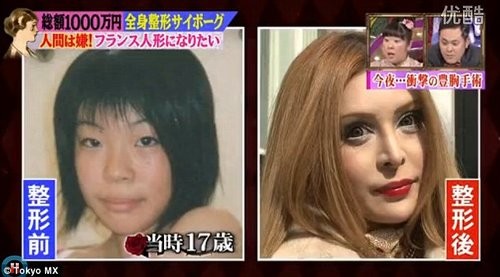 日本女生疯狂整容30余次，以期变成法国“瓷娃娃”