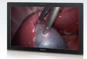 索尼8月推出全新32寸医用3D显示器