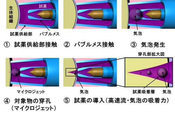 日本发明无针头注射器 研发者获赞“女神”