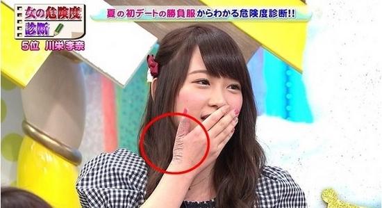 AKB48成员遭砍伤瞒9个月 右手几乎残废