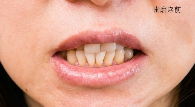 抚子牙膏含有小苏打成分 美白牙齿好帮手（二）