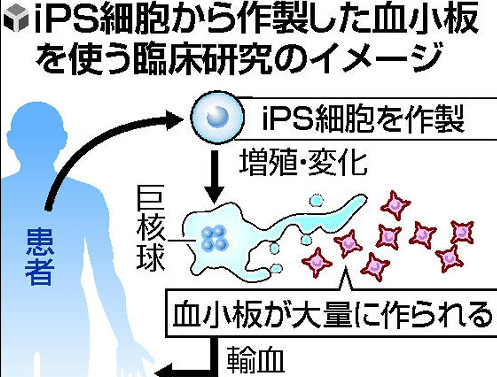 日本京都大学向厚劳省申请利用IPS细胞制作血小板的实验批准