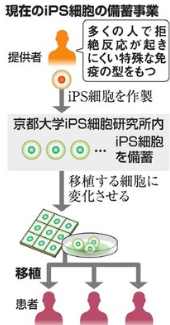 iPS细胞研究所提议退出京都大学
