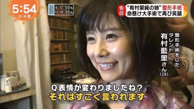 同样是整容 怎么他就被骂 日本通
