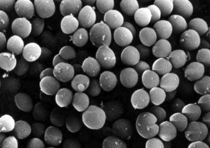 2017年日本因耐药菌死亡人数超8000人