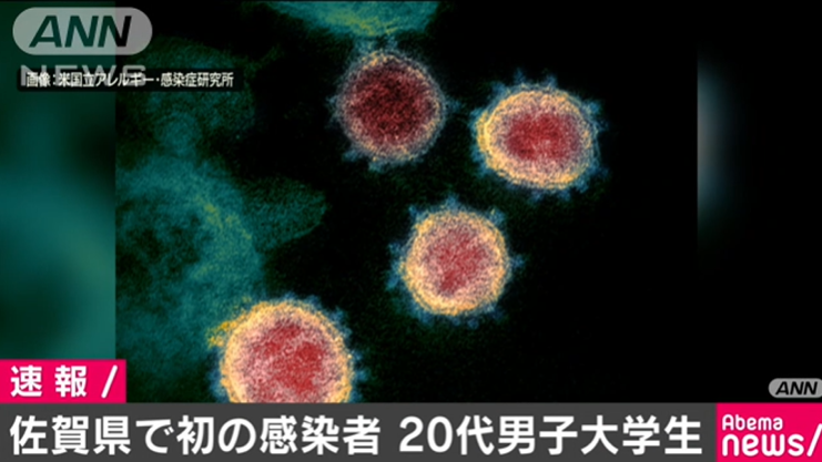 佐贺县确诊首例新冠肺炎病例，近期曾去法国旅游