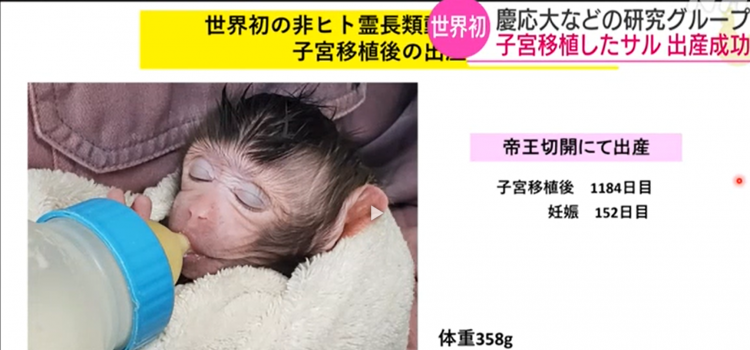 庆应大学宣布在猴子身上成功完成子宫移植手术，将进行人类移植试验