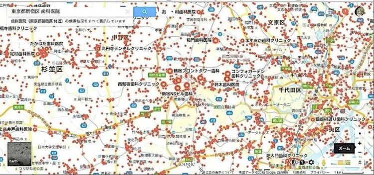 日本女孩的牙，为什么大多不好看？