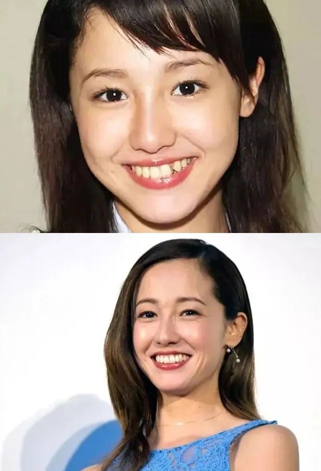 日本女孩的牙，为什么大多不好看？