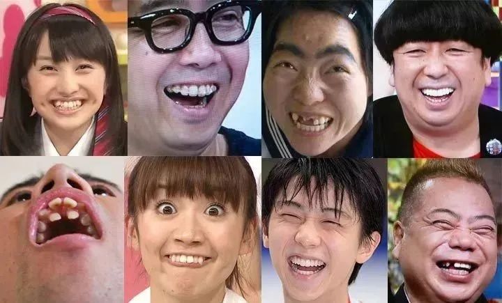 日本女孩的牙，为什么大多不好看？