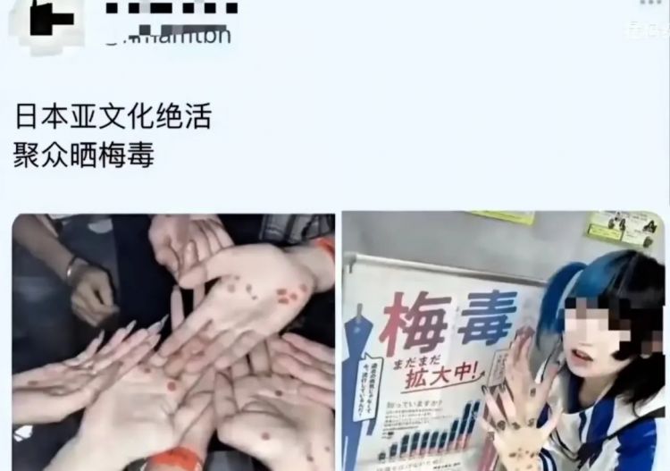“慢脚”惹上“梅毒妆”，东亚小孩彻底癫了？