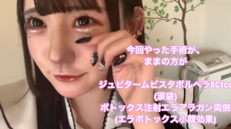 15岁少女整容失败引发热议，外表成‘蛇精’，网友愤怒：最狠的不是医生，而是她妈妈