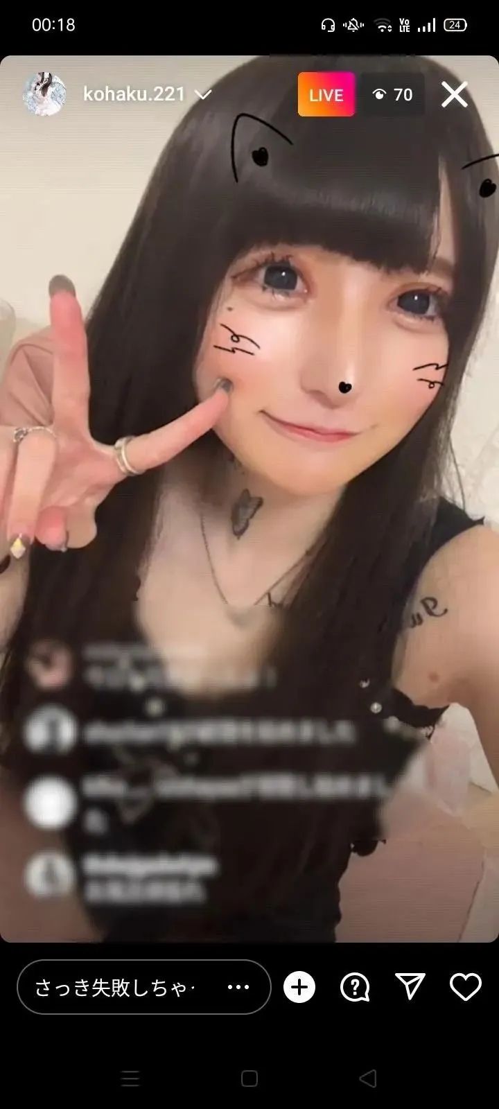 15岁少女整容失败引发热议，外表成‘蛇精’，网友愤怒：最狠的不是医生，而是她妈妈