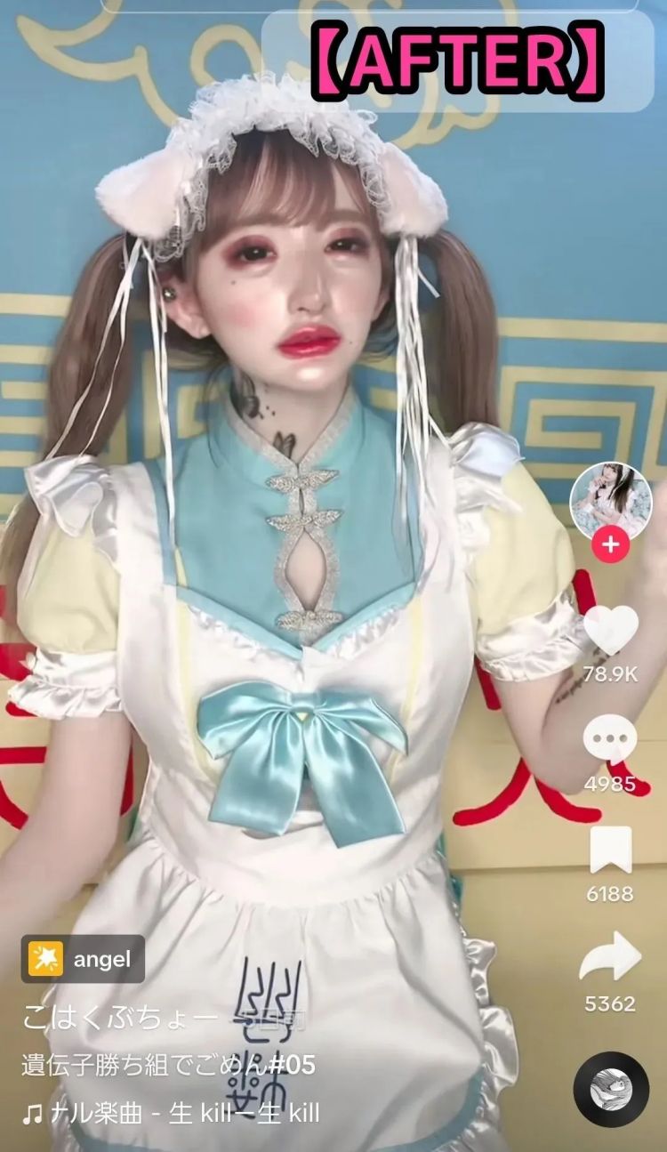 15岁少女整容失败引发热议，外表成‘蛇精’，网友愤怒：最狠的不是医生，而是她妈妈
