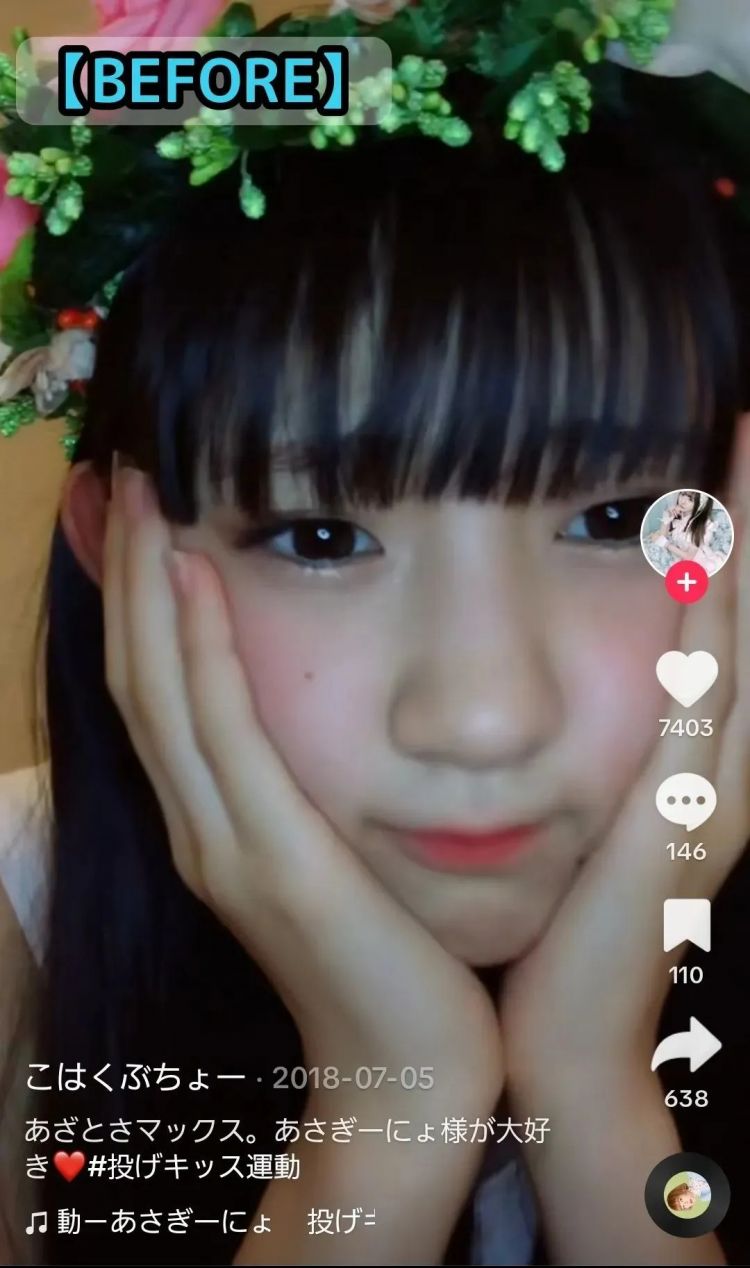 15岁少女整容失败引发热议，外表成‘蛇精’，网友愤怒：最狠的不是医生，而是她妈妈