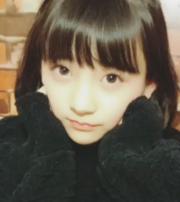 15岁少女整容失败引发热议，外表成‘蛇精’，网友愤怒：最狠的不是医生，而是她妈妈