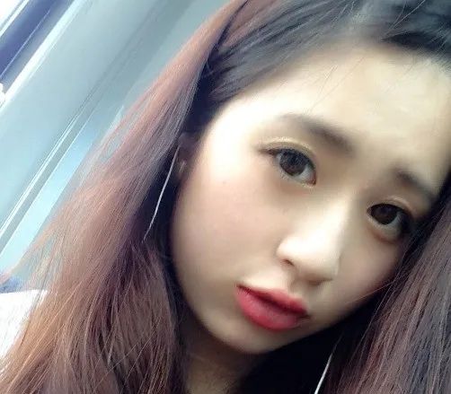 日本大专女孩打工途中左眼失明!恢复后出道当歌手,却被指责装可怜? 日本大专女孩打工途中左眼失明!恢复后出道当歌手,却被指责装可怜?