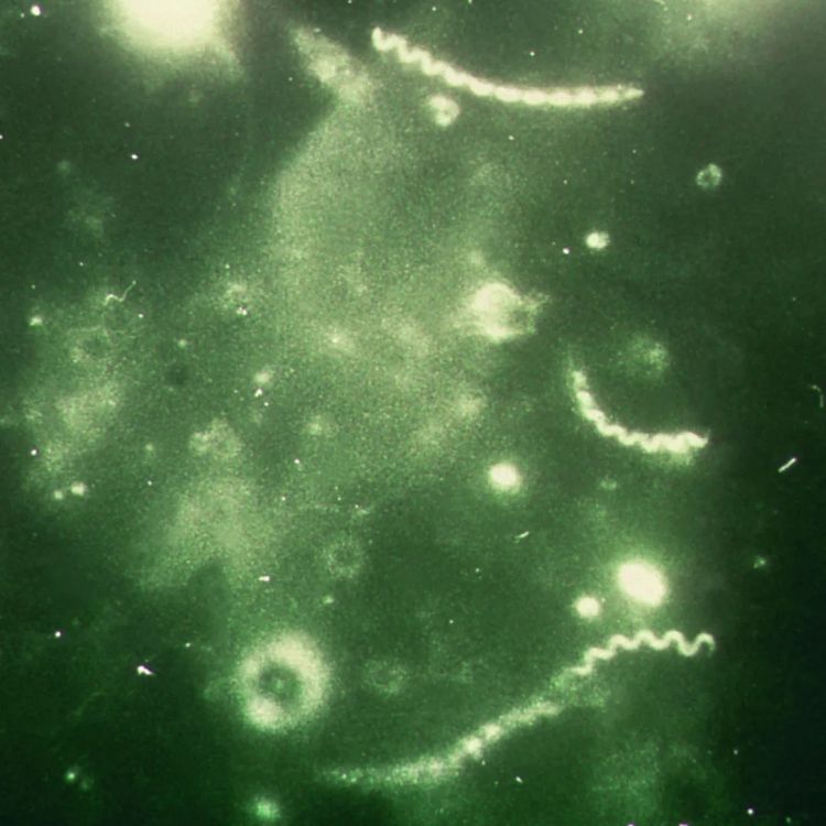 日本飙升的梅毒，到底是什么毒？